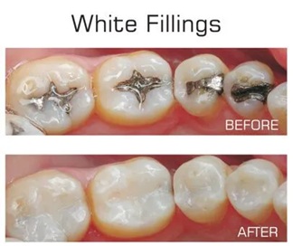 Cosmetic-Dentistry-San-Diego
