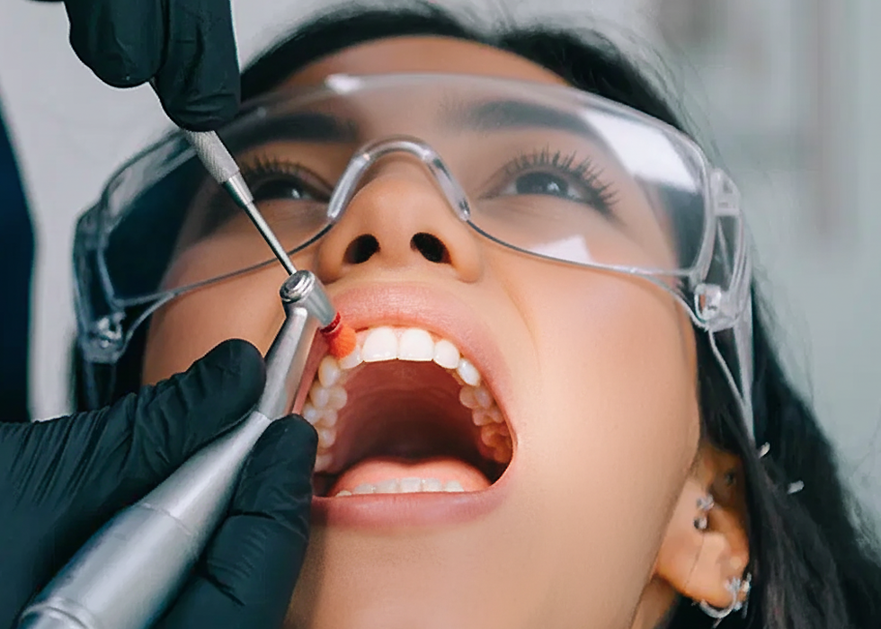 teeth-scaling-polishing-lakshacare-1