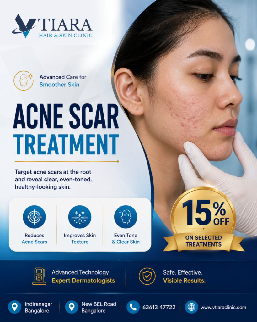 acne-scar-treatment-in-bangalore
